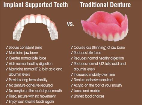 permanent vs traditional dentures